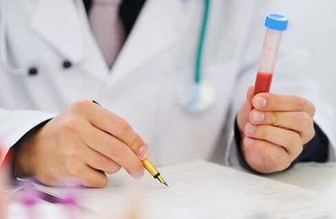 Tests for prostatitis to prescribe medication